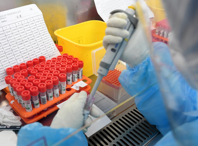 Số ca nhiễm COVID-19 trên toàn cầu vượt mốc 10 triệu người ảnh 1