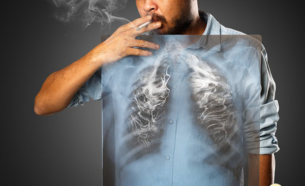 Quản lý thuốc lá thế hệ mới: Tránh kẽ hở gây tác động tiêu cực ảnh 1