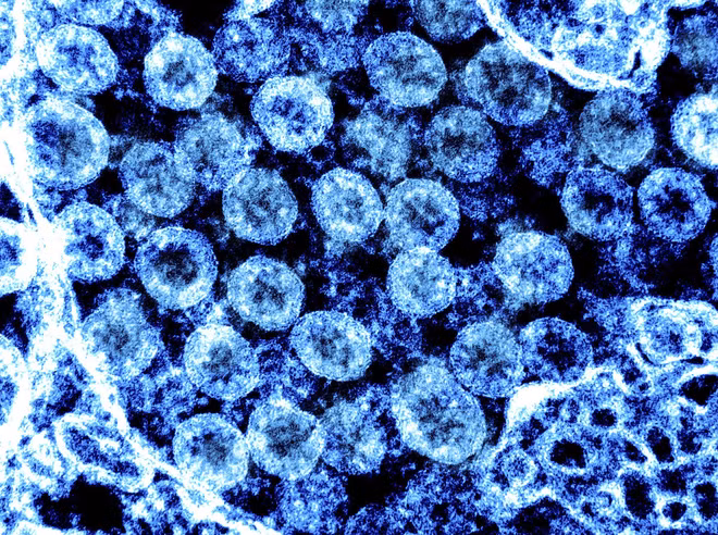 Sử dụng trí tuệ nhân tạo dự báo tiến hóa của virus SARS-CoV-2 ảnh 1