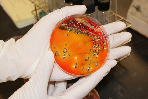 Hàng trăm người nhiễm vi khuẩn salmonella tại Australia ảnh 1