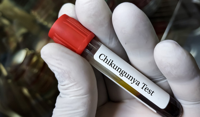 FDA đã phê duyệt vaccine đầu tiên ngừa virus Chikungunya. (Nguồn: Shutterstock) Mỹ phê duyệt vaccine đầu tiên trên thế giới ngừa virus Chikungunya ảnh 1