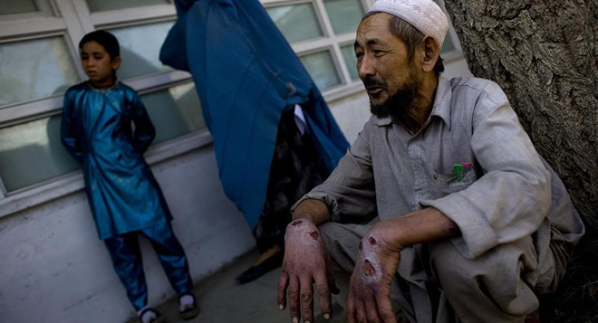 Syria: Dịch bệnh do trùng ký sinh ăn thịt người lây lan mạnh ảnh 1