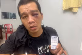 Đối tượng Võ Văn Sang, dùng dao và hơi cay để tấn công lực lượng Công an. (Ảnh: CA Thành phố Hồ Chí Minh cung cấp)