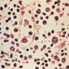 Mẫu bệnh phẩm của một bệnh nhân nhiễm virus Hanta. (Ảnh: Reuters/TTXVN)