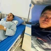 Hai anh em anh Vĩnh, anh Trung nhập viện sau khi bị hành hung. (Ảnh: Nhân vật cung cấp)