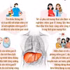 Đẩy nhanh giải pháp loại trừ viêm gan virus, giảm gánh nặng ung thư gan