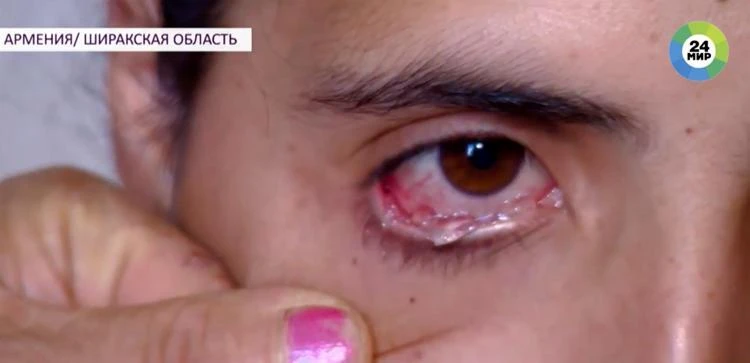 Satenik thường khóc ra những viên pha lê. (Nguồn: odditycentral.com)