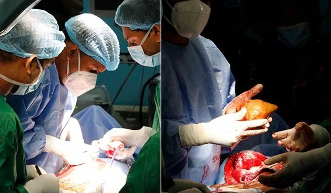 Sri Lanka: Phẫu thuật loại bỏ viên sỏi thận lớn nhất thế giới 