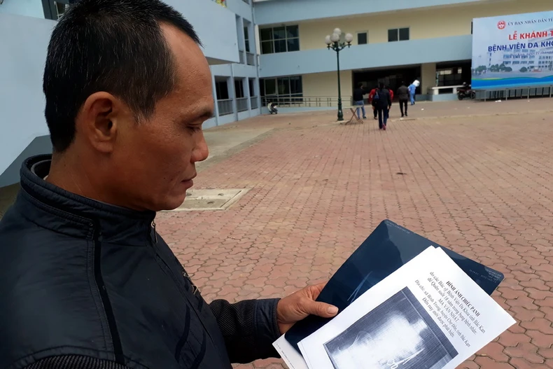 Hình ảnh chụp X-quang chiếc kéo trong ổ bụng của ông Nhật. (Ảnh: Bùi Đức Hiếu/TTXVN)