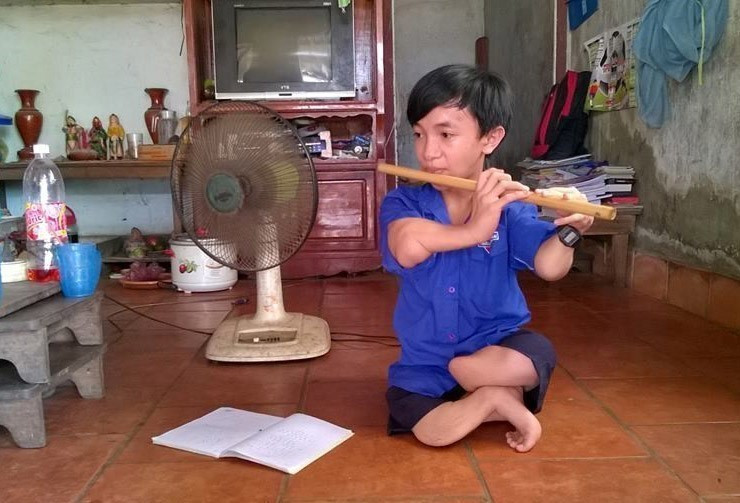 Trần Ái Hải Sơn, học sinh lớp 10A2 Trường THPT Thanh Hòa, huyện Bù Đốp (Bình Phước), dị tật di truyền từ người bố bị phơi nhiễm chất độc hóa học dioxin, là một tấm gương về khát vọng sống, nghị lực vươn lên trước sự khắc nghiệt của số phận. Nhiều năm liền là học sinh giỏi, khá của trường (4/2016). (Ảnh: K GỬIH/TTXVN)