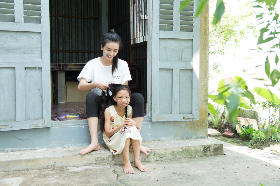 Được biết, theo dự án ‘Nụ cười trẻ thơ’ Ngọc Ánh sẽ được phẫu thuật vào năm tròn 15 tuổi khi hệ xương mặt phát triển hoàn thiện. (Ảnh: Tân Lê/Vietnam+) 