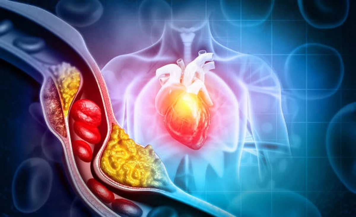 Loại Bỏ 3 Nhóm Thực Phẩm Này, Sức Khỏe Tim Mạch Có Thể Cải Thiện Rõ Rệt
