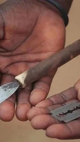 Phần tiểu phẫu trong nghi lễ trưởng thành dẫn đến cái chết của một số người tham gia mỗi năm. (Ảnh: Wvi).