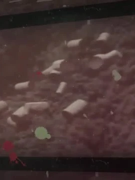 Hành trình tìm lại nụ cười cho em bé mang di chứng chất độc da cam