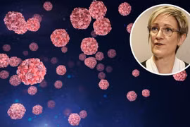 Tiến sỹ Clare Huppatz, Giám đốc Sở Y tế của bang Tây Australia, cho biết nhiều khả năng virus bắt nguồn từ một người đã đi du lịch nước ngoài. (Nguồn: Perthnow)