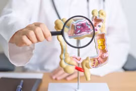 Những tổn thương đường tiêu hóa như loét hoặc xuất huyết có thể được điều trị bằng máy in sinh học cỡ viên thuốc. (Nguồn: Getty Images)