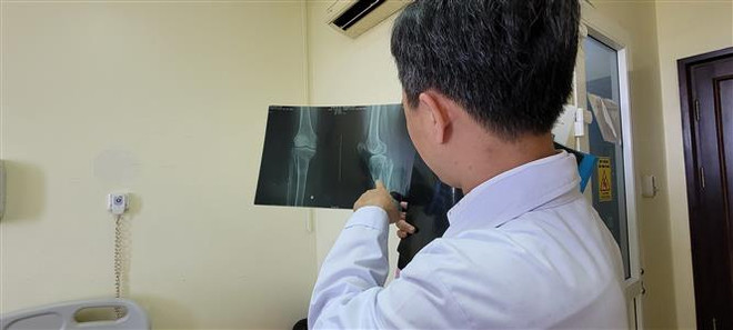 Cấp cứu thành công trường hợp bị đứt động mạch khoeo phức tạp ảnh 2