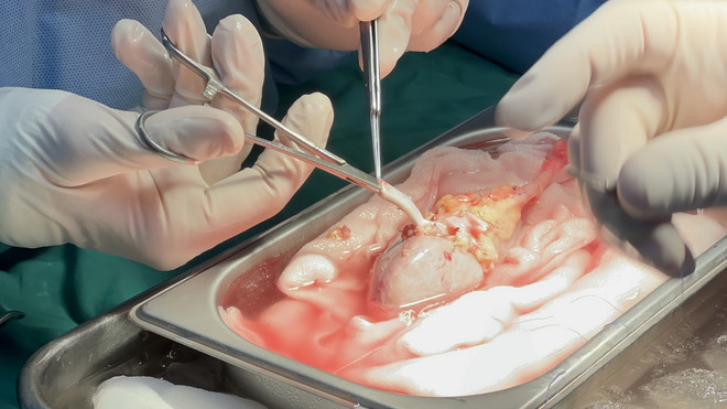 ttxvn_0905_ghep than (2).jpg