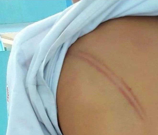 Cà Mau: Khởi tố mẹ kế đánh con chồng để lại 20 vết bầm tím ảnh 1