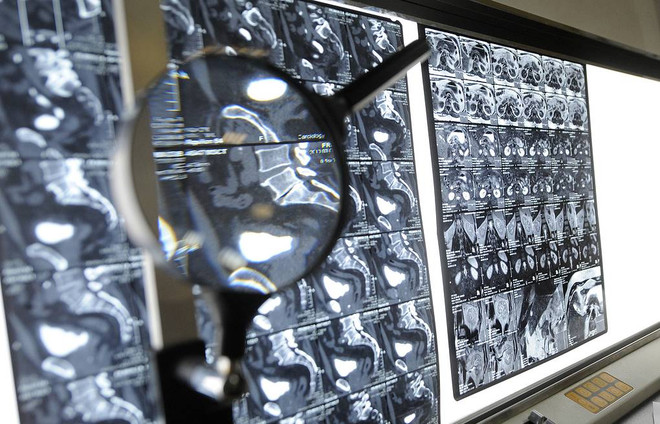 Nga phát triển thuốc điều trị ung thư mới có thể đạt hiệu quả hơn 90% ảnh 1