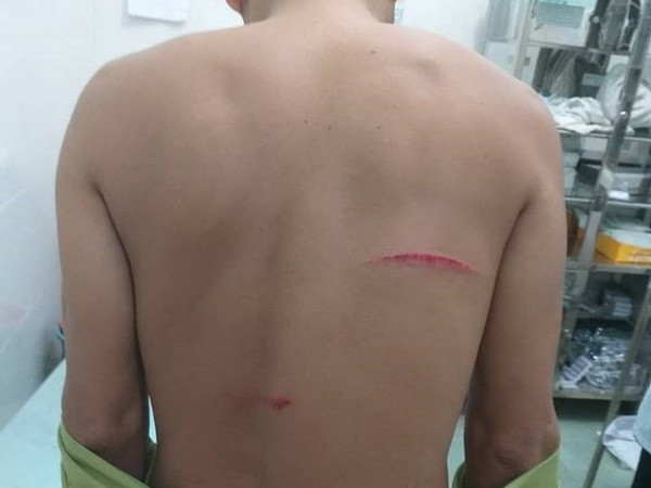 Gia Lai: Liên tiếp các vụ chống người thi hành công vụ về quản lý rừng ảnh 2