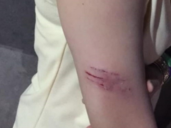 Bình Dương: Xuất hiện đàn khỉ tấn công học sinh để lấy đồ ăn ảnh 1