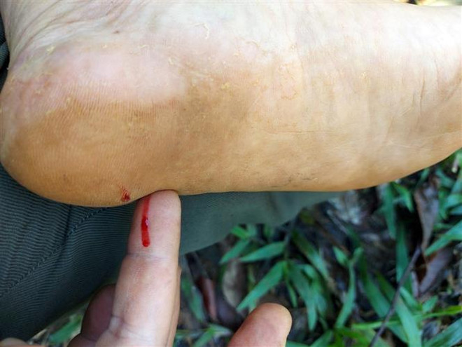 Đắk Nông: Lâm tặc cài bẫy đinh, ngăn cản lực lượng bảo vệ rừng ảnh 3