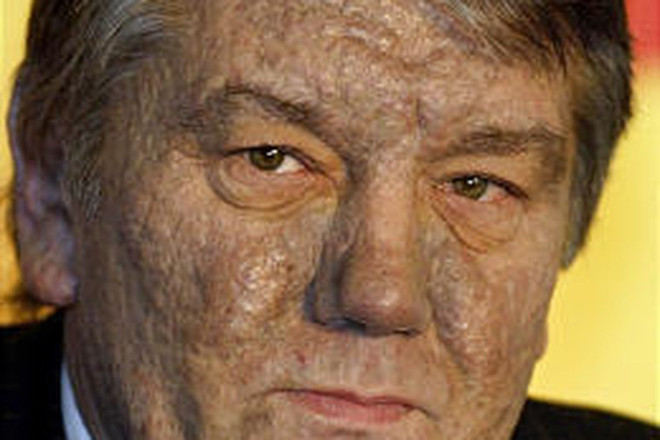 Những lùm xùm quanh vụ nhà đối lập nổi tiếng Navalny đang hôn mê ảnh 4