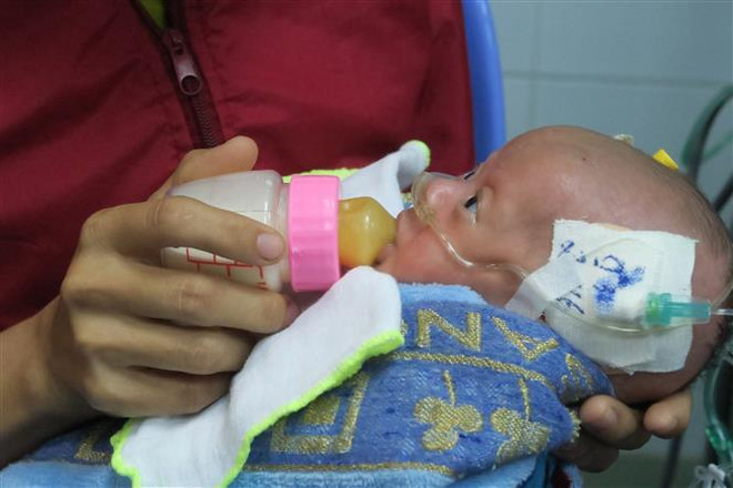 Phẫu thuật tim hở cho bệnh nhi nhẹ cân nhất từ trước đến nay ảnh 1