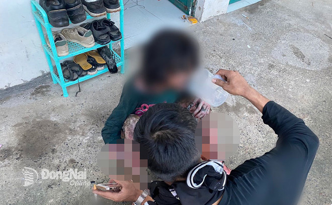 Đồng Nai: Phóng hỏa do ghen tuông mù quáng khiến 7 người bị bỏng nặng ảnh 1