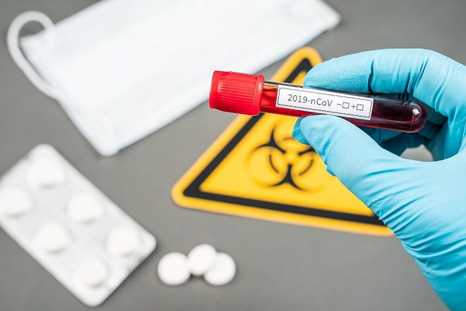 Cộng hòa Séc xác nhận 3 trường hợp nhiễm virus SARS-CoV-2 đầu tiên ảnh 1