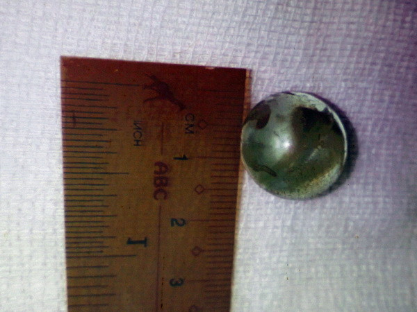 Lấy súng tự chế dọa đùa, dượng bắn đạn xuyên vào hốc mắt cháu 3 tuổi ảnh 1