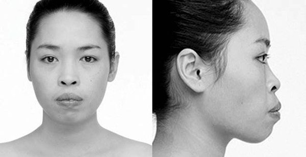 Năm phụ nữ chia sẻ thẳng thắn về hành trình thay đổi diện mạo ảnh 2