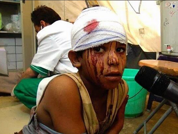 Liên quân Saudi Arabia không kích Houthi, 10 trẻ em thiệt mạng ảnh 1