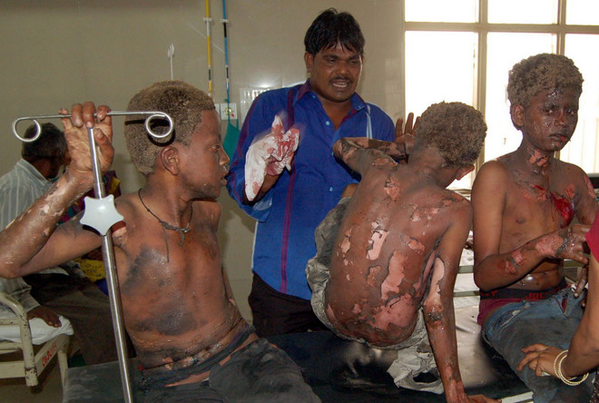 [Photo] Nổ nhà máy dệt Ấn Độ, ít nhất 30 người bị thương ảnh 1