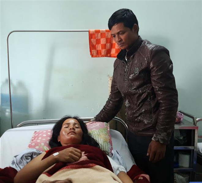 Vụ nổ đầu đạn ở Kon Tum: Tiếp tục tích cực điều trị cho các nạn nhân ảnh 2