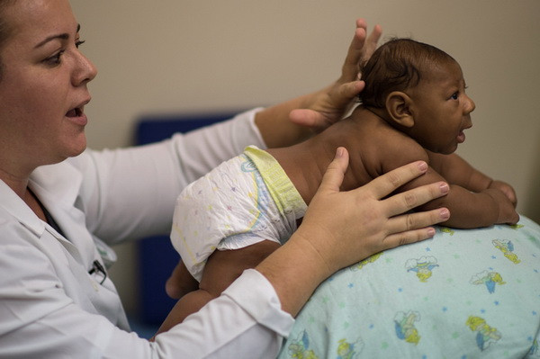 Một em bé bị mắc chứng đầu nhỏ do virus zika được điều trị tại bệnh viện ở Salvador, Brazil. (Nguồn: AFP/TTXVN) Trẻ dị tật đầu nhỏ gặp nhiều vấn đề trong quá trình phát triển ảnh 1