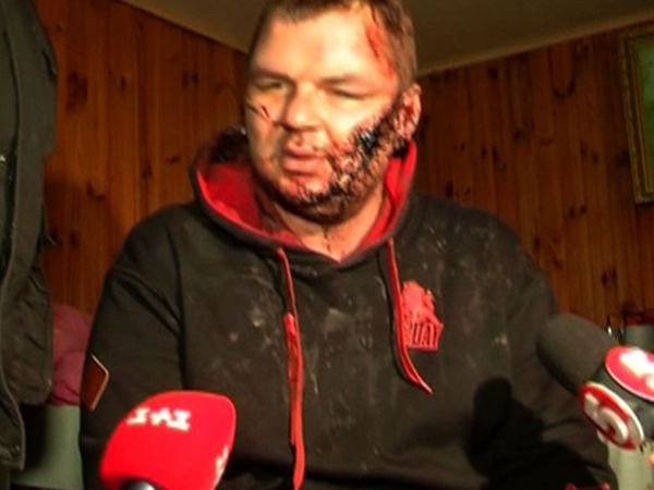 Đụng độ đẫm máu ở Kiev, hơn 100 người thương vong ảnh 1