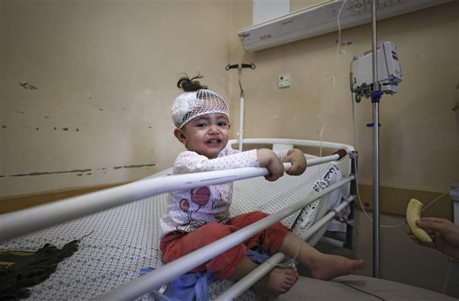 Một em bé Palestine bị thương, sau loạt không kích của Israel xuống Dải Gaza, được điều trị tại bệnh viện Al-Shifa. (Ảnh: AFP/TTXVN) Xung đột Israel-Palestine: Quốc tế hối thúc bảo vệ người dân ảnh 1