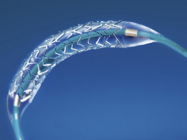 Khuyến cáo mới sau phẫu thuật đặt ống stent nong mạch vành ảnh 1