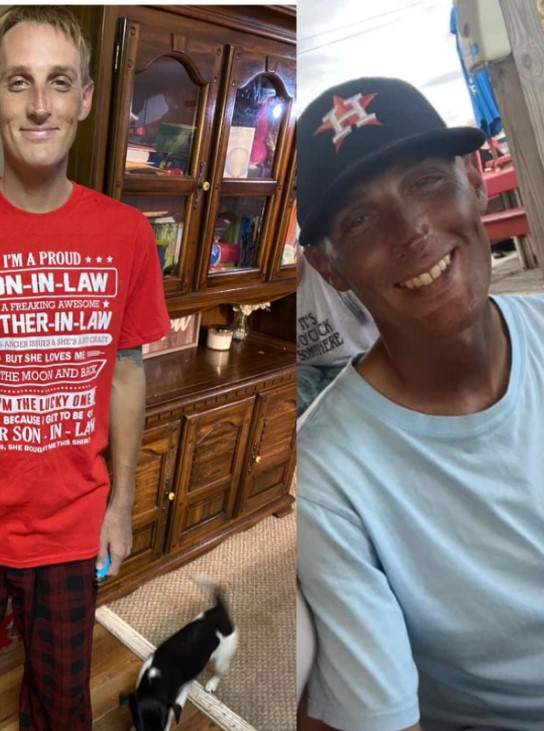 Bất ngờ bị đổi màu da sau khi uống thuốc chống trầm cảm ảnh 2