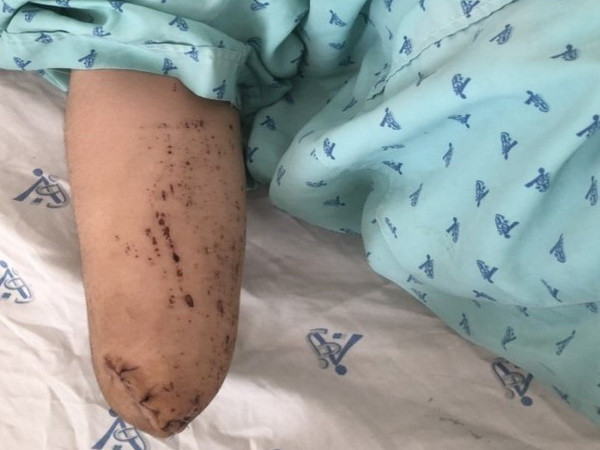 Tiếp nhận hơn 242.00 bệnh nhân khám, cấp cứu trong 5 ngày nghỉ Tết ảnh 1