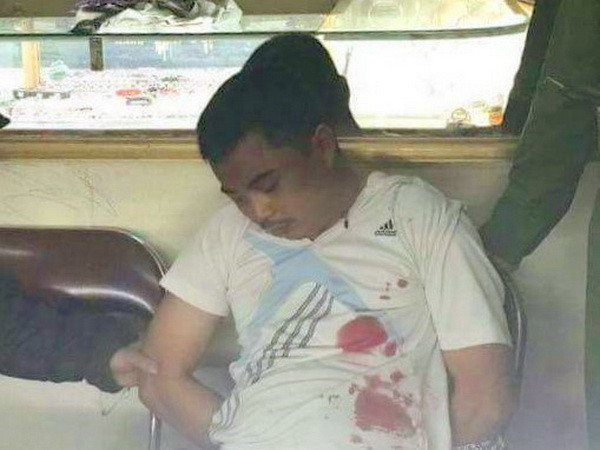 Công an Hà Nội làm rõ vụ cướp tiệm vàng tại đường Láng ảnh 1