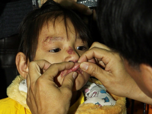 Khám bệnh miễn phí cho 200 bệnh nhân nghèo bị dị tật ảnh 1