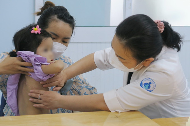 TP.HCM: Phẫu thuật “2 trong 1” cứu bé gái 3 tuổi bị lõm ngực nặng ảnh 1