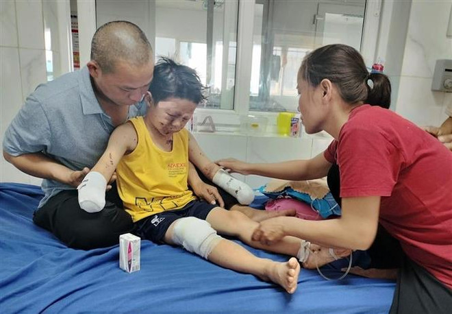 Đắk Lắk: Xác minh nguyên nhân vụ nổ làm hai bé trai bị thương ảnh 1