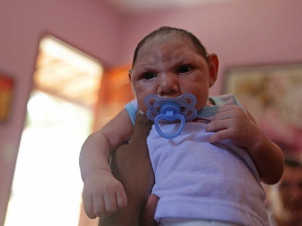 Haiti có trường hợp trẻ sơ sinh đầu tiên bị đầu nhỏ do Zika ảnh 1