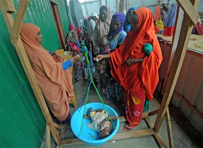 Trẻ em bị suy dinh dưỡng điều trị tại một trung tâm y tế ở ngoại ô Mogadishu, Somalia. (Ảnh: AFP/TTXVN) WB cảnh báo tác động của dịch COVID-19 đối với an ninh lương thực ảnh 1