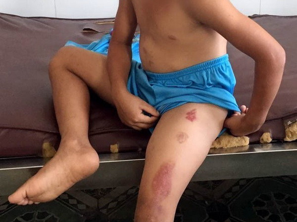 Sóc Trăng: Điều tra vụ cha dượng bạo hành con riêng của vợ ảnh 1