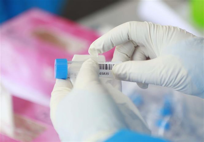 Điện Biên ghi nhận thêm 4 trường hợp dương tính với SARS-CoV-2 ảnh 1